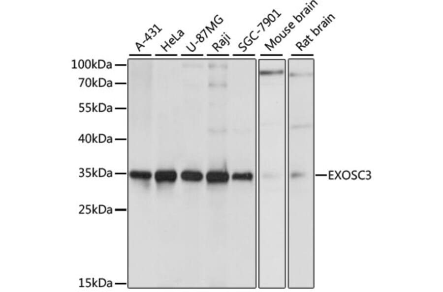 Western Blot - Anti-EXOSC3 Antibody (A80690) - Antibodies.com