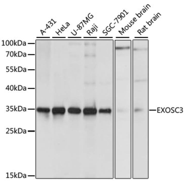 Western Blot - Anti-EXOSC3 Antibody (A80690) - Antibodies.com