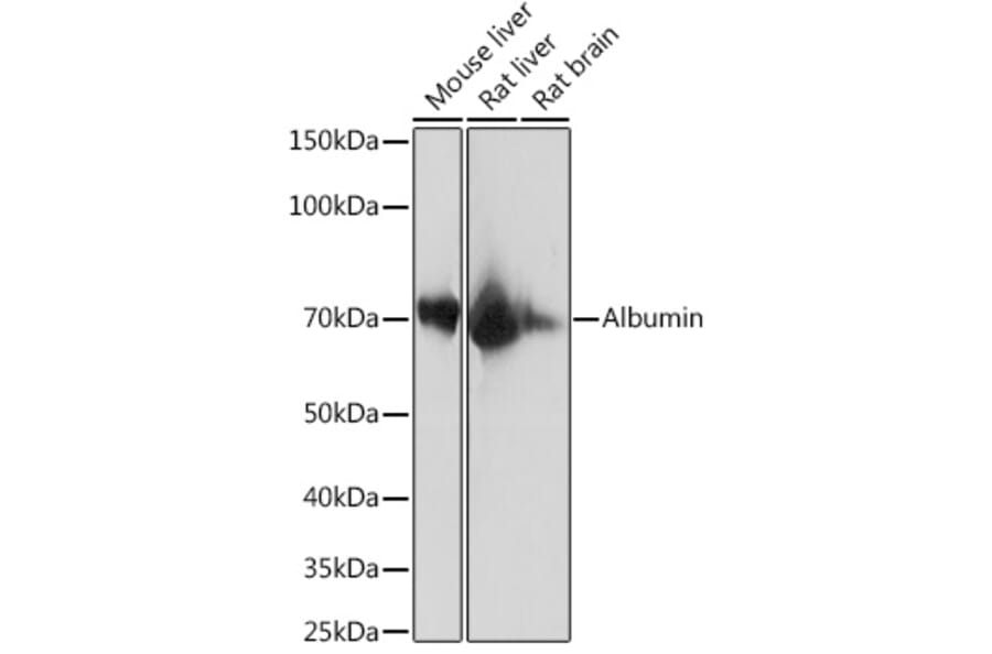 Western Blot - Anti-Bovine Serum Albumin Antibody [ARC0647] (A80691) - Antibodies.com