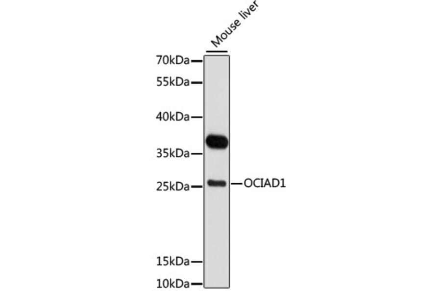 Western Blot - Anti-OCIAD1 Antibody (A80692) - Antibodies.com