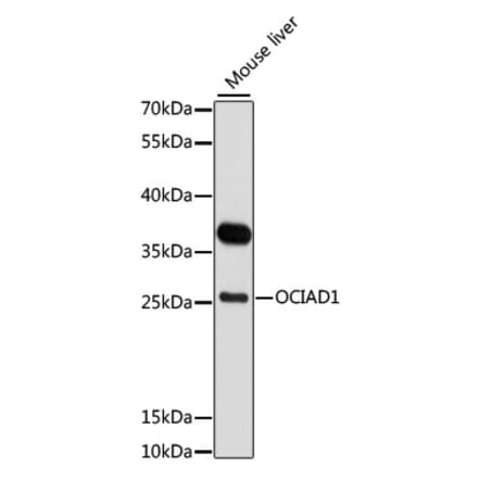 Western Blot - Anti-OCIAD1 Antibody (A80692) - Antibodies.com