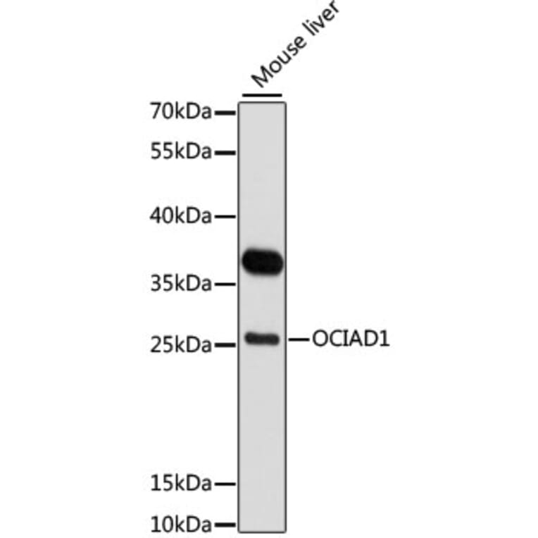 Western Blot - Anti-OCIAD1 Antibody (A80692) - Antibodies.com