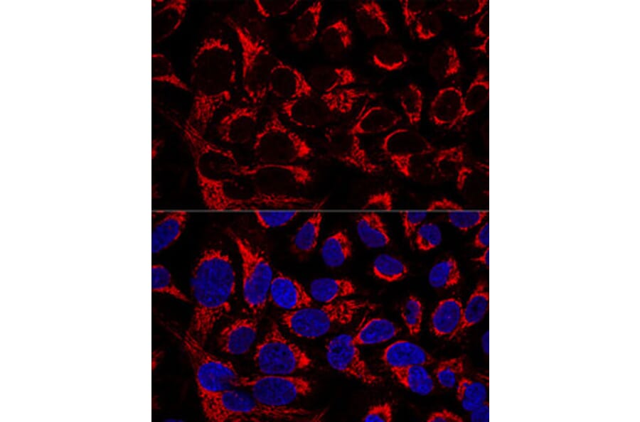 Immunofluorescence - Anti-OCIAD1 Antibody (A80692) - Antibodies.com
