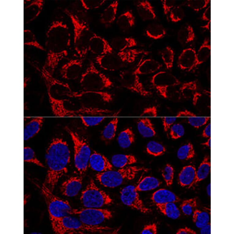 Immunofluorescence - Anti-OCIAD1 Antibody (A80692) - Antibodies.com