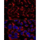 Immunofluorescence - Anti-OCIAD1 Antibody (A80692) - Antibodies.com