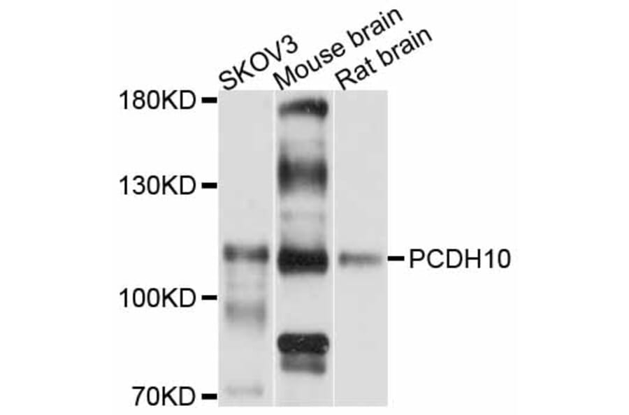 Western Blot - Anti-PCDH10 Antibody (A11632) - Antibodies.com