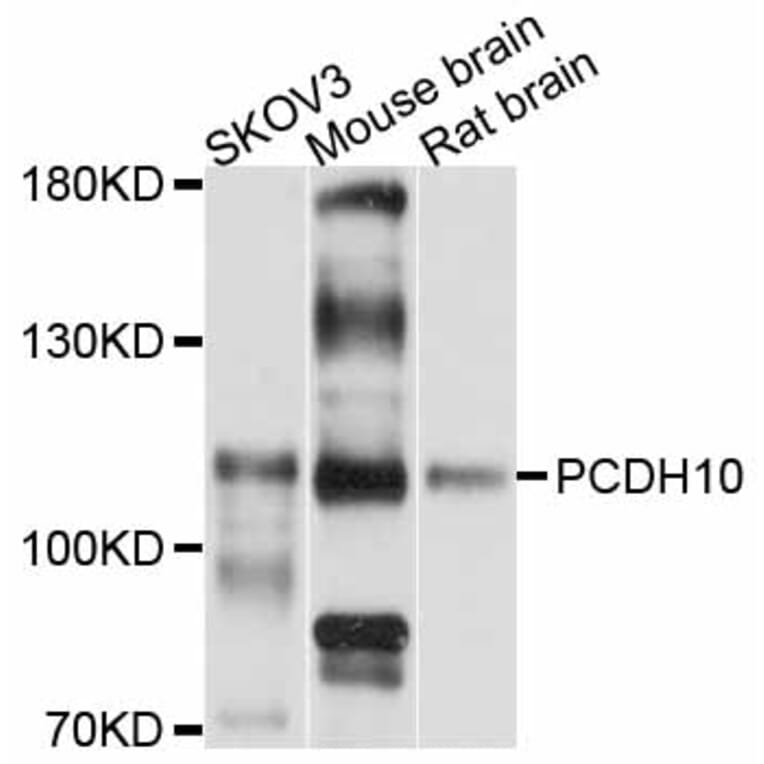 Western Blot - Anti-PCDH10 Antibody (A11632) - Antibodies.com
