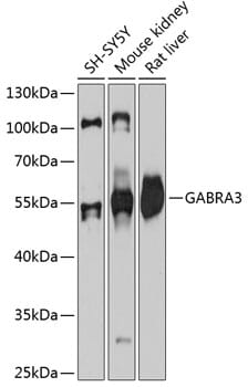 Western blot analysis of extracts of various cell lines, using Anti-GABRA3 Antibody (A11636) at 1:3000 dilution.
Secondary antibody: Goat Anti-Rabbit IgG (H+L) (HRP) (AS014) at 1:10,000 dilution.
Lysates / proteins: 25µg per lane.
Blocking buffer: 3% non-fat dry milk in TBST.
Detection: ECL Basic Kit (RM00020).
Exposure time: 30s.