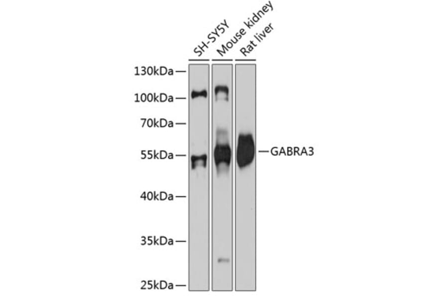 Western Blot - Anti-GABA A Receptor alpha 3/GABRA3 Antibody (A80694) - Antibodies.com