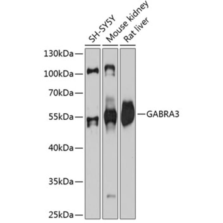 Western Blot - Anti-GABA A Receptor alpha 3/GABRA3 Antibody (A80694) - Antibodies.com