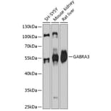 Western Blot - Anti-GABA A Receptor alpha 3/GABRA3 Antibody (A80694) - Antibodies.com