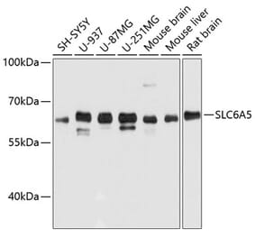 Western Blot - Anti-Glyt2 Antibody (A80696) - Antibodies.com