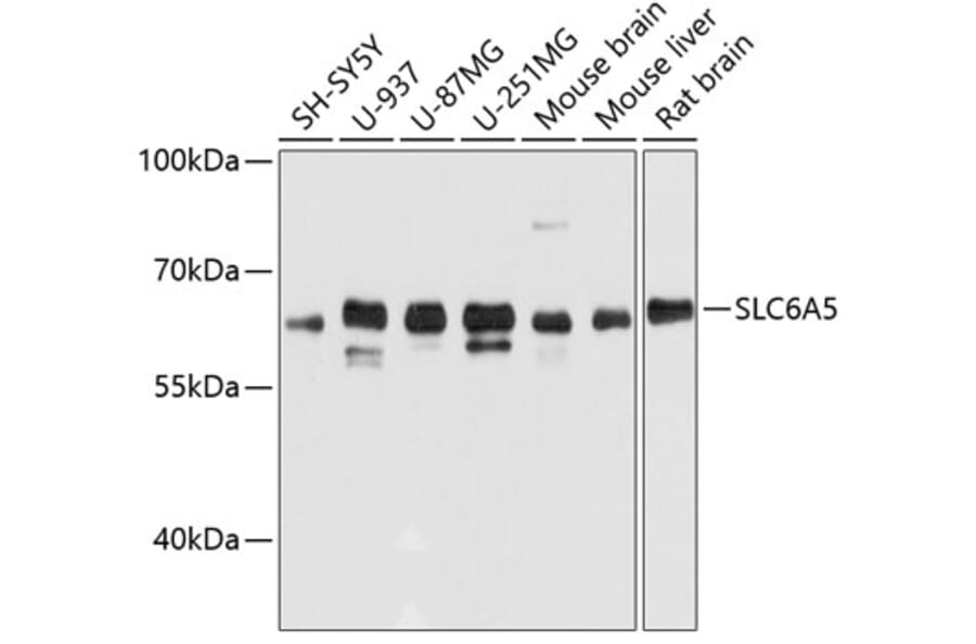 Western Blot - Anti-Glyt2 Antibody (A80696) - Antibodies.com