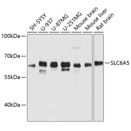 Western Blot - Anti-Glyt2 Antibody (A80696) - Antibodies.com