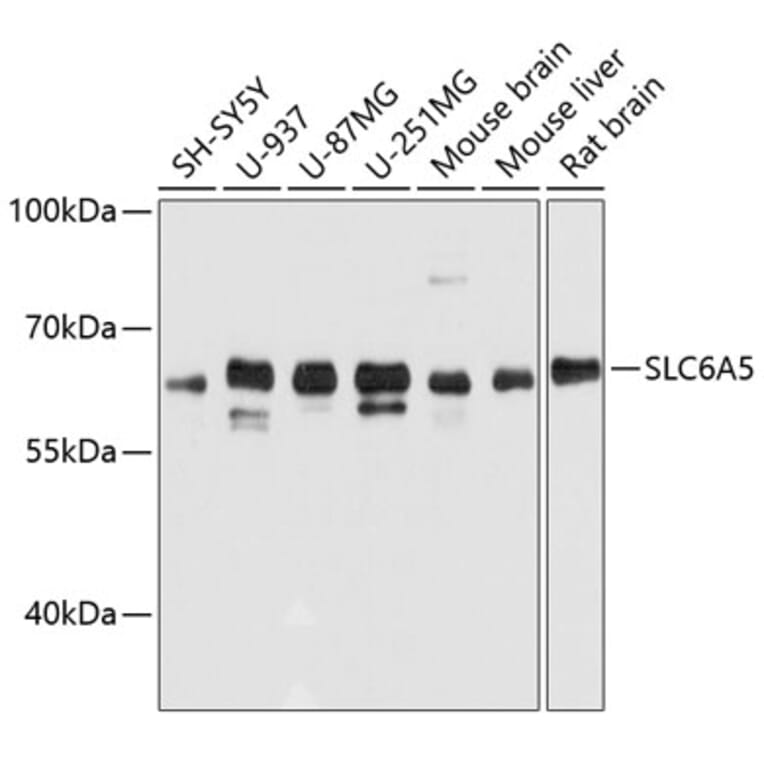 Western Blot - Anti-Glyt2 Antibody (A80696) - Antibodies.com