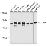 Western Blot - Anti-Glyt2 Antibody (A80696) - Antibodies.com