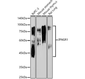 Western Blot - Anti-IFNGR1 Antibody [ARC50421] (A80697) - Antibodies.com