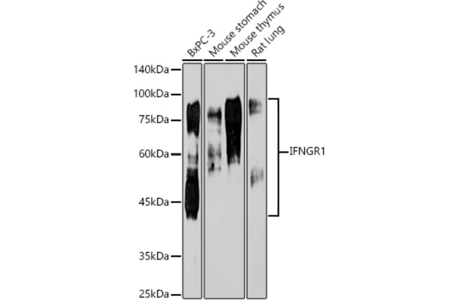 Western Blot - Anti-IFNGR1 Antibody [ARC50421] (A80697) - Antibodies.com