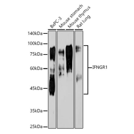 Western Blot - Anti-IFNGR1 Antibody [ARC50421] (A80697) - Antibodies.com