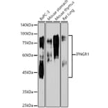 Western Blot - Anti-IFNGR1 Antibody [ARC50421] (A80697) - Antibodies.com