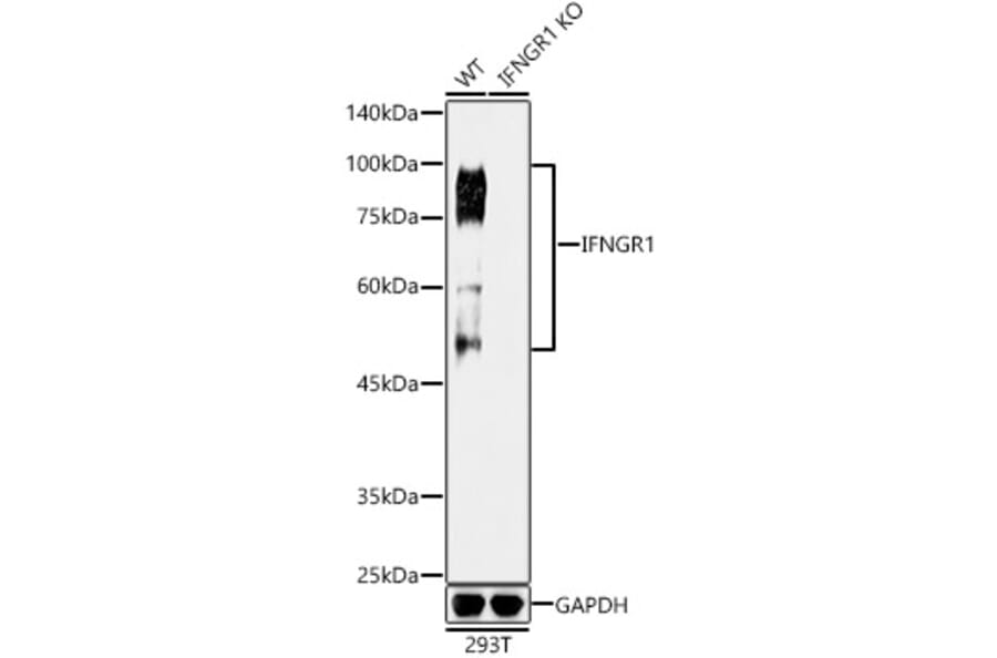 Western Blot - Anti-IFNGR1 Antibody [ARC50421] (A80697) - Antibodies.com