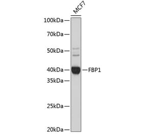 Western Blot - Anti-FBP1 Antibody [ARC0664] (A80698) - Antibodies.com