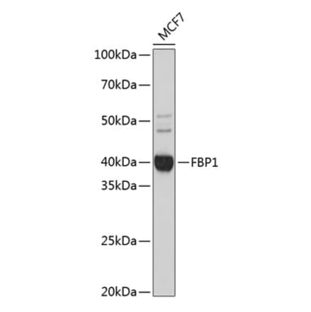 Western Blot - Anti-FBP1 Antibody [ARC0664] (A80698) - Antibodies.com