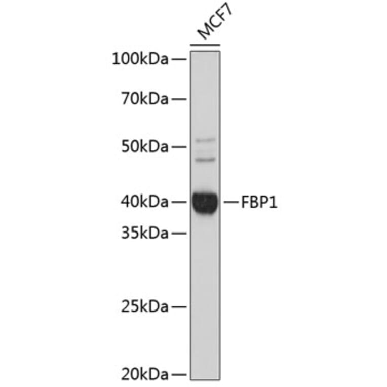 Western Blot - Anti-FBP1 Antibody [ARC0664] (A80698) - Antibodies.com