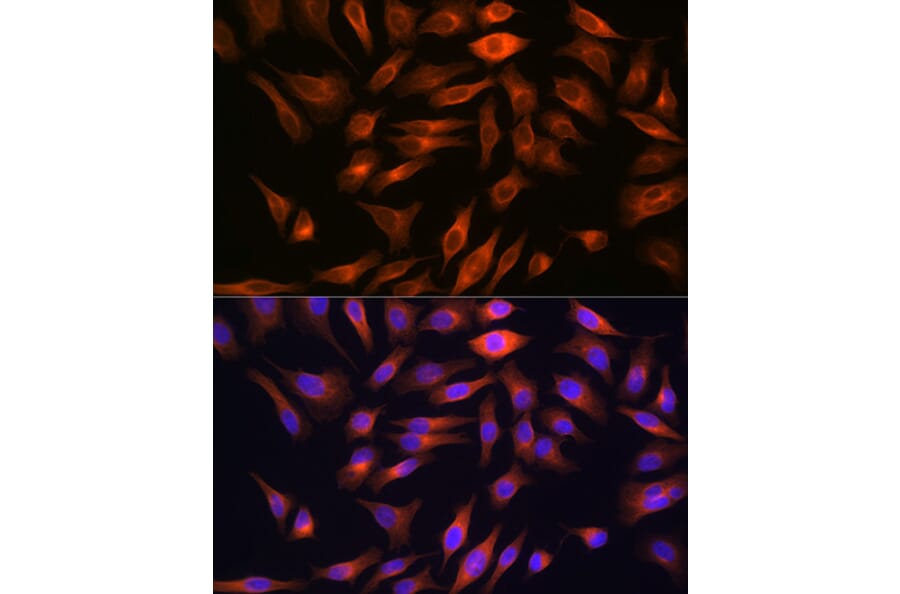 Immunofluorescence - Anti-FBP1 Antibody [ARC0664] (A80698) - Antibodies.com