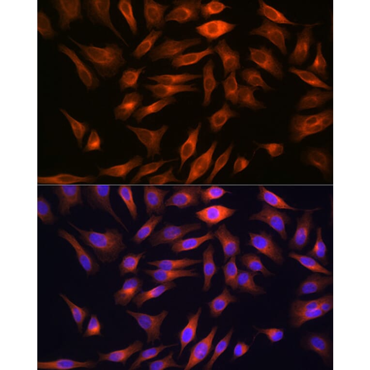 Immunofluorescence - Anti-FBP1 Antibody [ARC0664] (A80698) - Antibodies.com