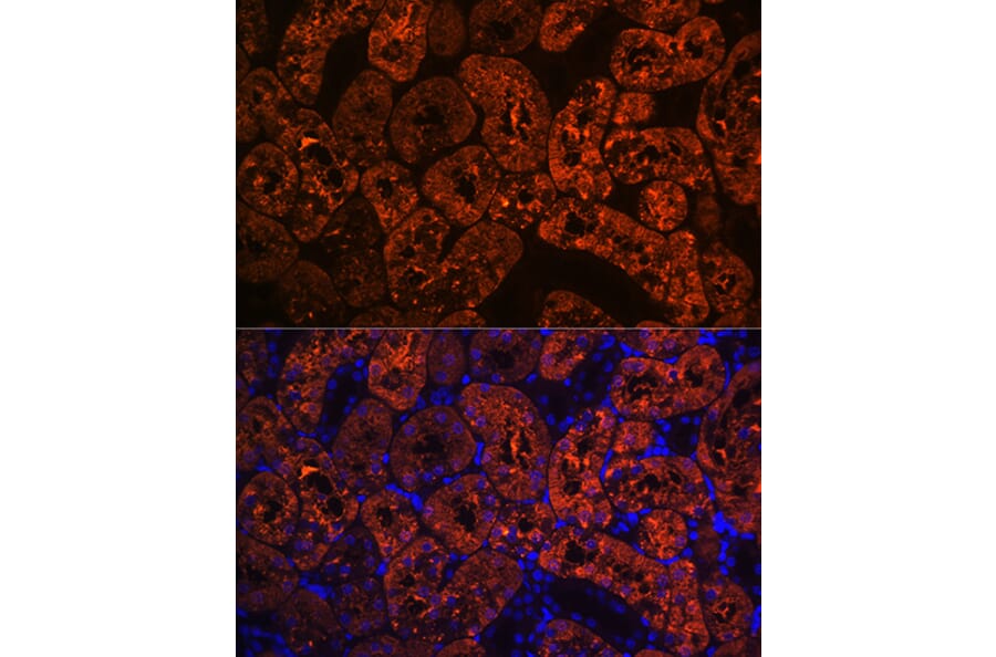 Immunofluorescence - Anti-FBP1 Antibody [ARC0664] (A80698) - Antibodies.com