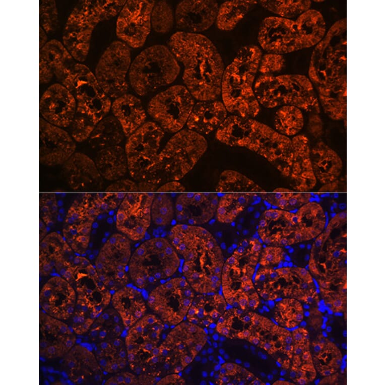 Immunofluorescence - Anti-FBP1 Antibody [ARC0664] (A80698) - Antibodies.com