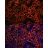 Immunofluorescence - Anti-FBP1 Antibody [ARC0664] (A80698) - Antibodies.com