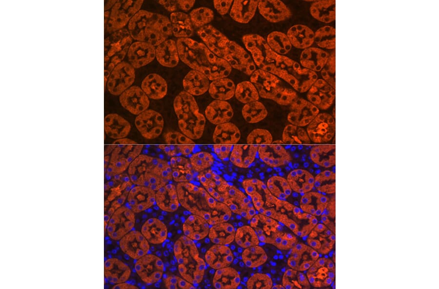 Immunofluorescence - Anti-FBP1 Antibody [ARC0664] (A80698) - Antibodies.com
