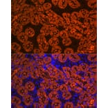 Immunofluorescence - Anti-FBP1 Antibody [ARC0664] (A80698) - Antibodies.com