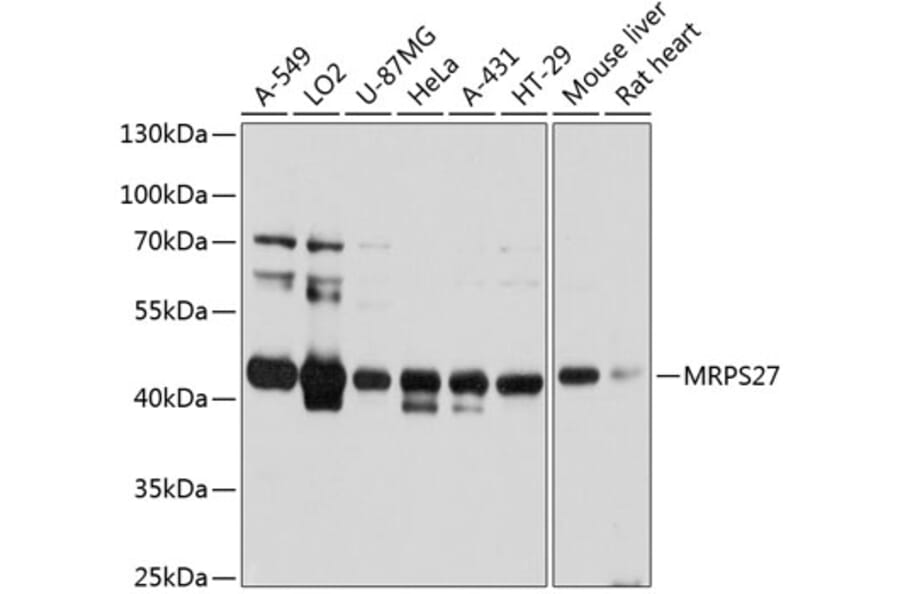 Western Blot - Anti-MRPS27 Antibody (A80699) - Antibodies.com