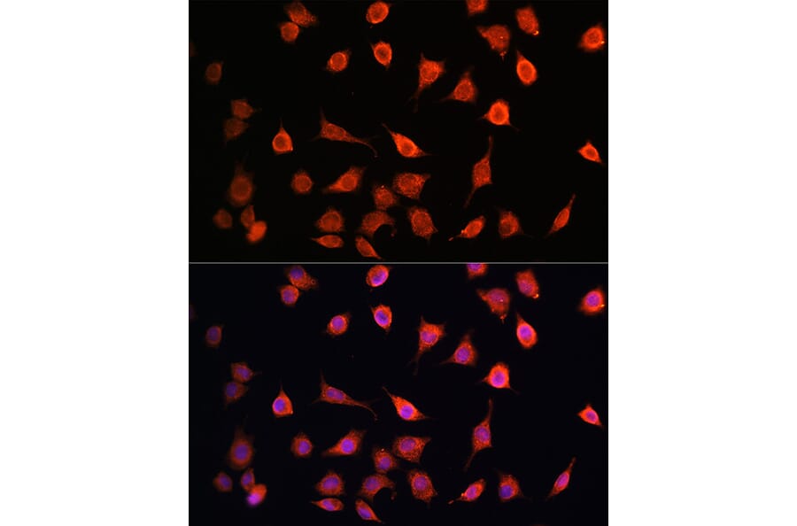 Immunofluorescence - Anti-MRPS27 Antibody (A80699) - Antibodies.com