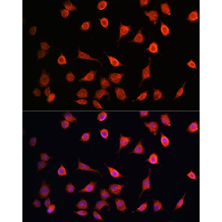 Immunofluorescence - Anti-MRPS27 Antibody (A80699) - Antibodies.com