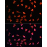 Immunofluorescence - Anti-MRPS27 Antibody (A80699) - Antibodies.com