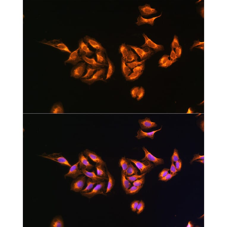 Immunofluorescence - Anti-MRPS27 Antibody (A80699) - Antibodies.com