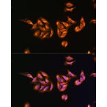 Immunofluorescence - Anti-MRPS27 Antibody (A80699) - Antibodies.com