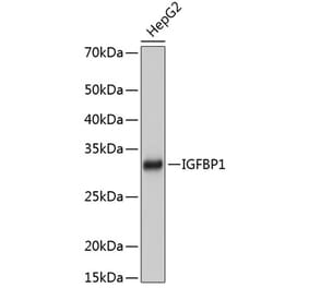 Western Blot - Anti-IGFBP1 Antibody [ARC0671] (A80700) - Antibodies.com
