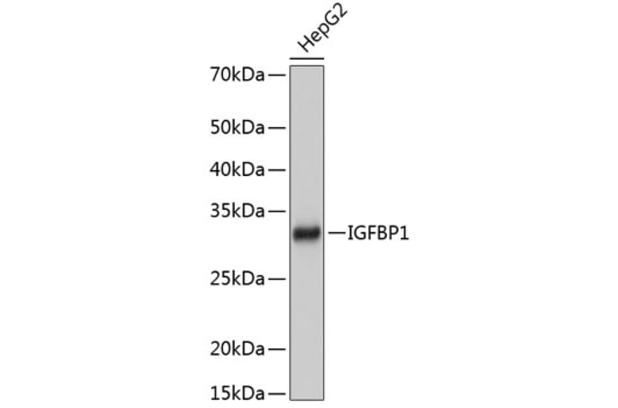 Western Blot - Anti-IGFBP1 Antibody [ARC0671] (A80700) - Antibodies.com