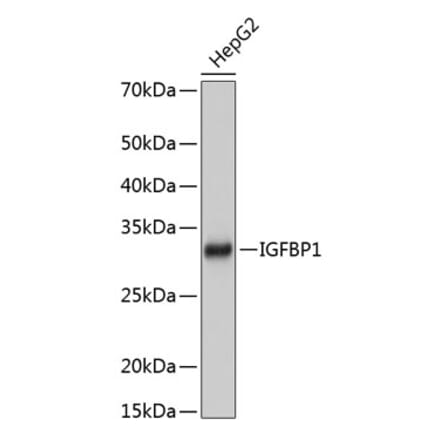 Western Blot - Anti-IGFBP1 Antibody [ARC0671] (A80700) - Antibodies.com