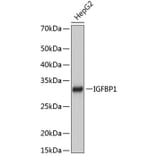 Western Blot - Anti-IGFBP1 Antibody [ARC0671] (A80700) - Antibodies.com