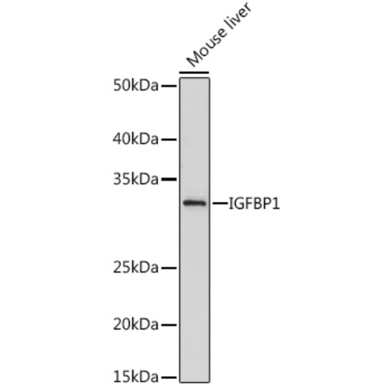 Western Blot - Anti-IGFBP1 Antibody [ARC0671] (A80700) - Antibodies.com