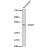 Western Blot - Anti-IGFBP1 Antibody [ARC0671] (A80700) - Antibodies.com