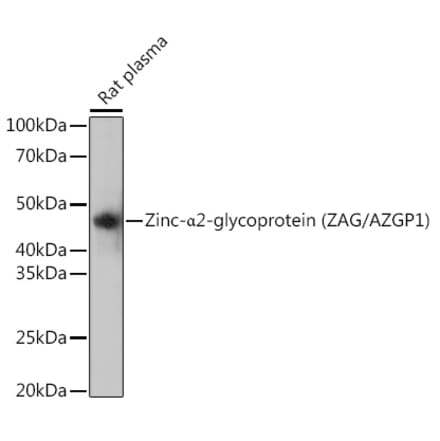 Western Blot - Anti-Zinc Alpha 2 Glycoprotein Antibody [ARC0673] (A80702) - Antibodies.com