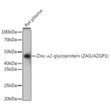 Western Blot - Anti-Zinc Alpha 2 Glycoprotein Antibody [ARC0673] (A80702) - Antibodies.com
