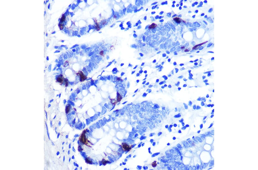 Immunohistochemistry - Anti-Zinc Alpha 2 Glycoprotein Antibody [ARC0673] (A80702) - Antibodies.com